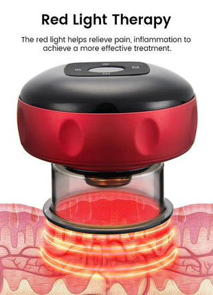 Smart 6/12 Gear Vacuum Cupping Massage Electric