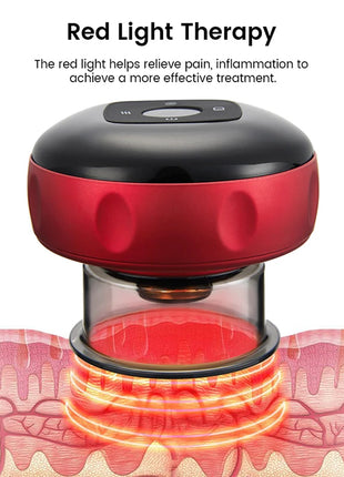 Smart 6/12 Gear Vacuum Cupping Massage Electric